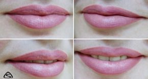 До и после перманентного макияжа губ в холодном розовом цвете